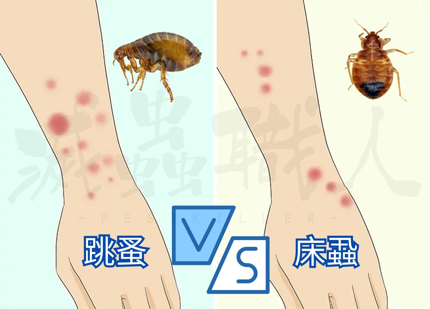 床蝨與跳蚤咬痕外觀對比圖