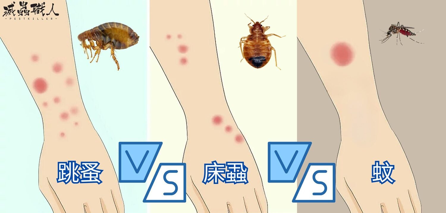 床蝨咬點算?5大床蝨咬特徵、蝨咬/蚤咬症狀辨識全攻略